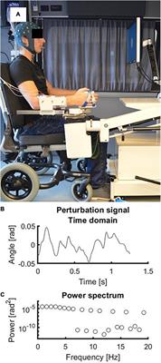 The Cortical Response Evoked by Robotic Wrist Perturbations Reflects Level of Proprioceptive Impairment After Stroke